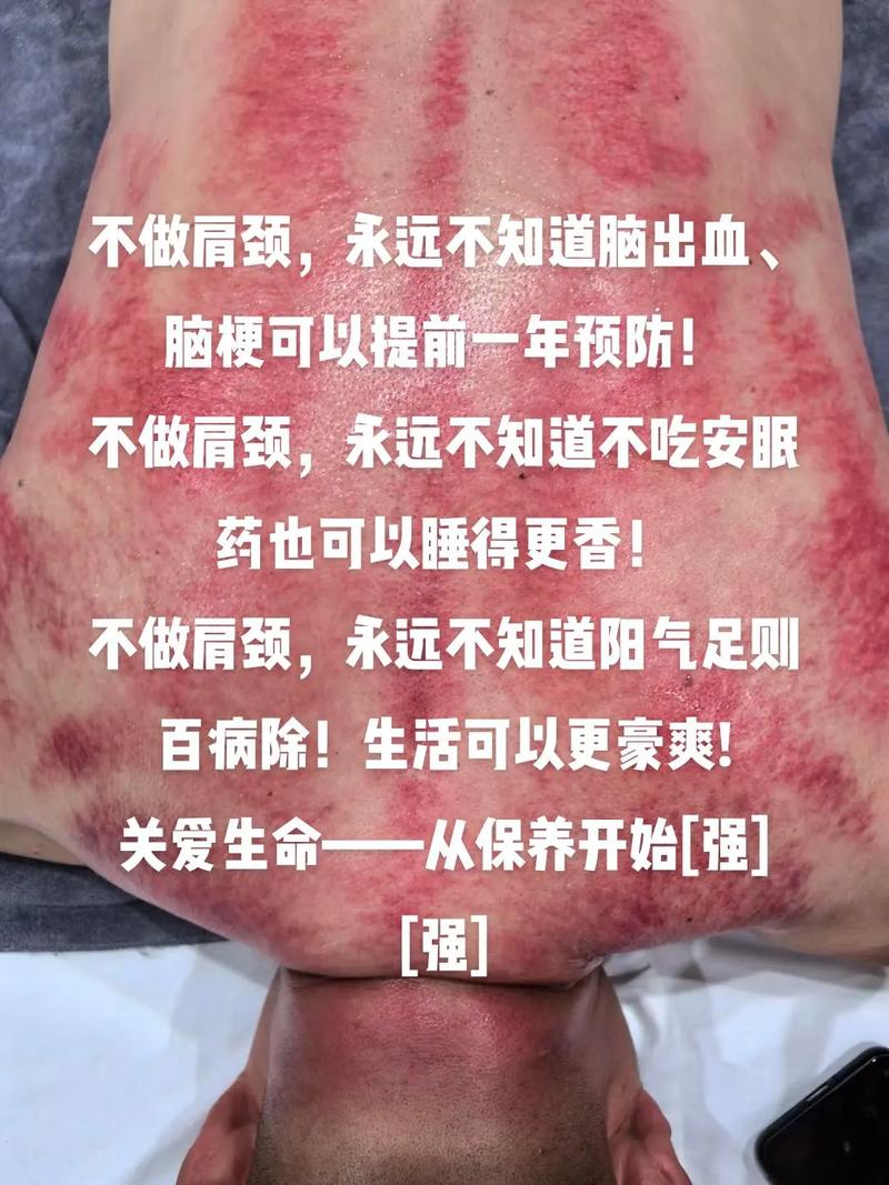 按摩肩颈急性脑梗死;按摩肩颈急性脑梗死有效果吗